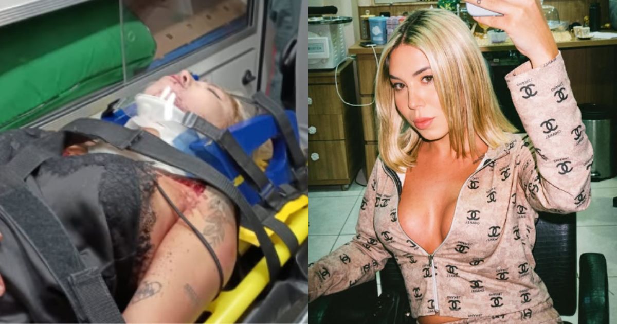Moradora de Florianópolis denunciou ter sido atropelada por motorista de app ‘chapado’Foto: Reprodução/@mmiaasophie/ND Mais