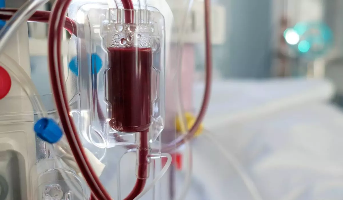 A hemodiálise é um tratamento médico que utiliza uma máquina para filtrar e limpar o sangue, substituindo a função dos rins quando estes estão doentes ou com insuficiência graveFoto: Divulgação/Partmed/ND